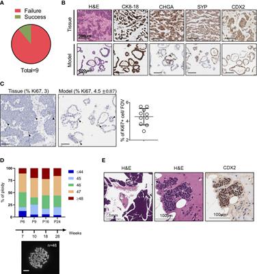 Long-term organoid culture of a small intestinal neuroendocrine tumor